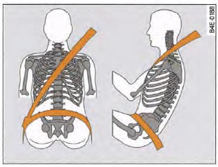 Positionnement de la sangle baudrier et de la sangle sous-abdominale