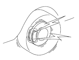 Lorsque ce son est audible, s'adresser à un